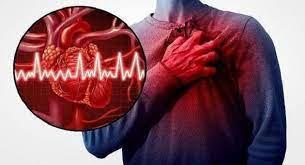 Cardiovascular Problems Induced Erectile Dysfunction